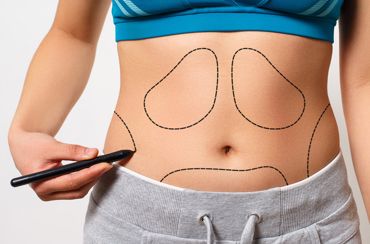 Ανάπλαση Σώματος