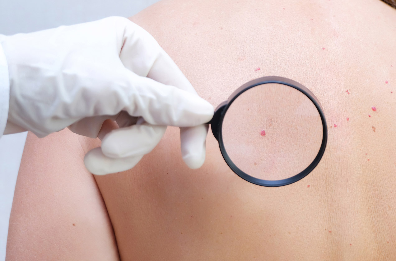 Δερματοχειρουργική